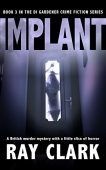 Implant Ray Clark